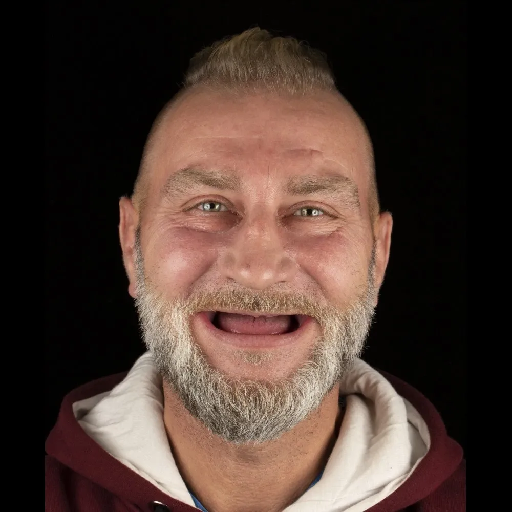 Результат до после клиники Grandmed